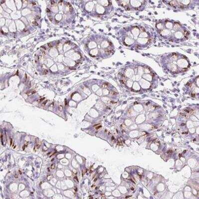 Immunohistochemistry: FGFBP3 Antibody [NBP2-30824]