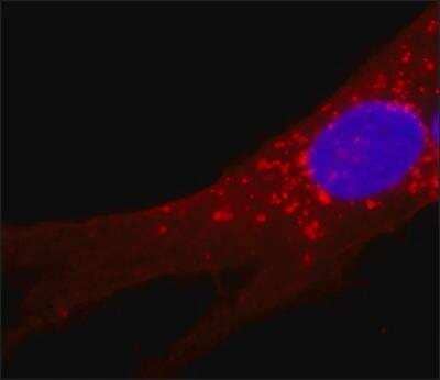 Immunocytochemistry/ Immunofluorescence: Fibroblast Surface Protein Antibody (1B10) [NB100-1845]