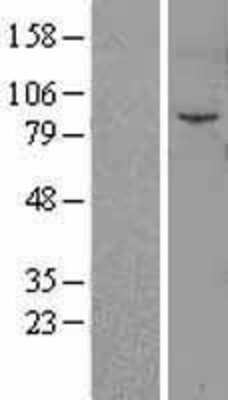 Western Blot: Fibroblast Activation Protein alpha/FAP Overexpression Lysate [NBL1-10592]