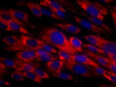 Immunocytochemistry/ Immunofluorescence: Fibroblasts Antibody (TE-7) [NBP2-50082]