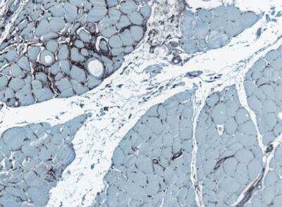 Immunohistochemistry-Paraffin: Fibroblasts Antibody (TE-7) [NBP2-50082]