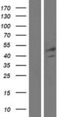 Western Blot: FGL2/Fibroleukin Overexpression Lysate [NBP2-10401]