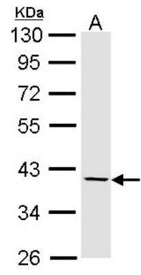 Western Blot: Fibromodulin/FMOD Antibody [NBP1-31657]