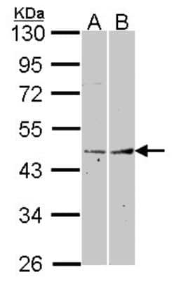 Western Blot: Fibromodulin/FMOD Antibody [NBP2-16494]