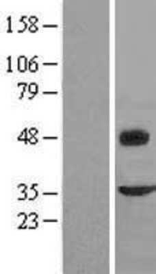 Western Blot: Fibromodulin/FMOD Overexpression Lysate [NBL1-10778]