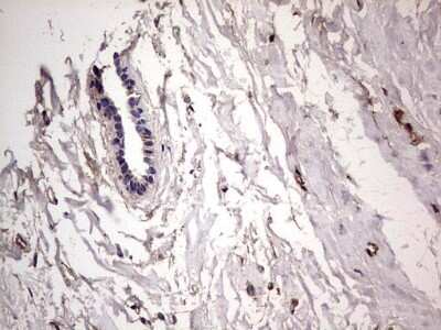 Immunohistochemistry: Fibronectin Antibody (OTI5C1) [NBP2-45690]