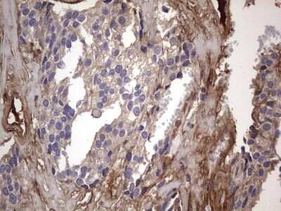 Immunohistochemistry: Fibronectin Antibody (OTI5C1) [NBP2-45690]