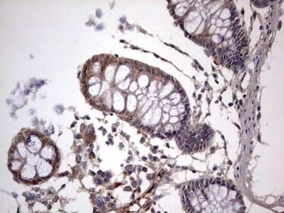 Immunohistochemistry: Fibronectin Antibody (OTI5C1) [NBP2-45690]