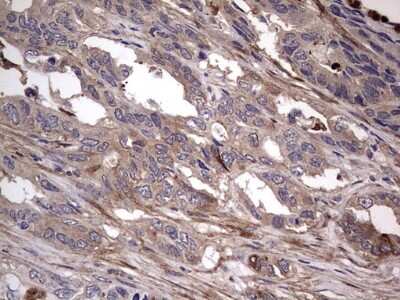 Immunohistochemistry: Fibronectin Antibody (OTI5C1) [NBP2-45690]