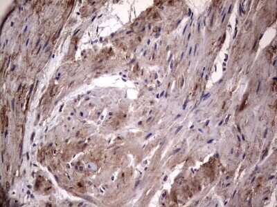 Immunohistochemistry: Fibronectin Antibody (OTI5C1) [NBP2-45690]