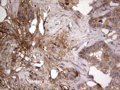 Immunohistochemistry: Fibronectin Antibody (OTI5C1) [NBP2-45690]
