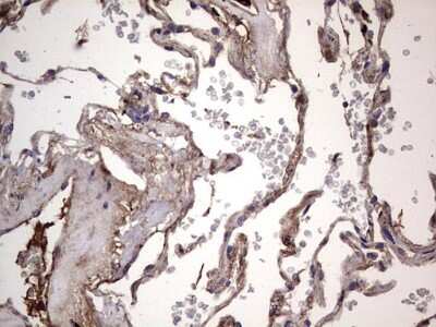 Immunohistochemistry: Fibronectin Antibody (OTI5C1) [NBP2-45690]