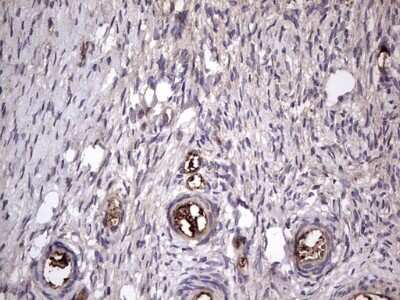 Immunohistochemistry: Fibronectin Antibody (OTI5C1) [NBP2-45690]