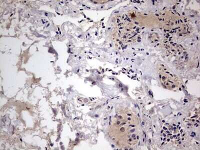 Immunohistochemistry: Fibronectin Antibody (OTI5C1) [NBP2-45690]