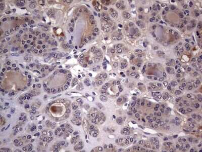 Immunohistochemistry: Fibronectin Antibody (OTI5C1) [NBP2-45690]