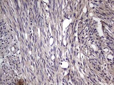 Immunohistochemistry: Fibronectin Antibody (OTI5C1) [NBP2-45690]
