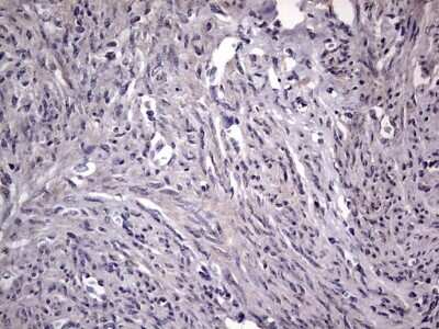 Immunohistochemistry: Fibronectin Antibody (OTI5C1) [NBP2-45690]