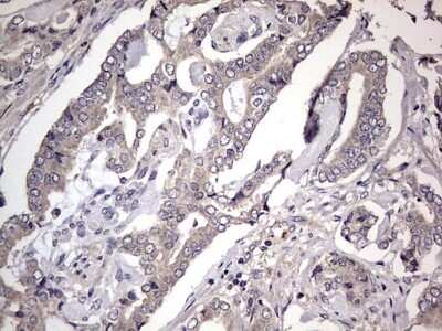 Immunohistochemistry: Fibronectin Antibody (OTI5C1) [NBP2-45690]