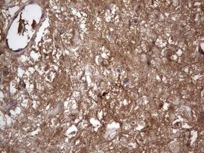 Immunohistochemistry: Fibronectin Antibody (OTI5C1) [NBP2-45690]