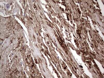 Immunohistochemistry: Fibronectin Antibody (OTI5C1) [NBP2-45690]