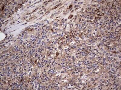Immunohistochemistry: Fibronectin Antibody (OTI5C1) [NBP2-45690]