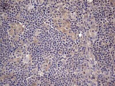 Immunohistochemistry: Fibronectin Antibody (OTI5C1) [NBP2-45690]