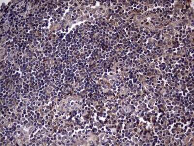 Immunohistochemistry: Fibronectin Antibody (OTI5C1) [NBP2-45690]