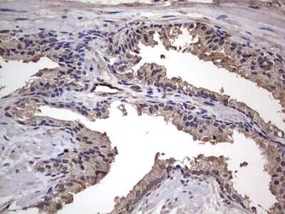 Immunohistochemistry: Fibronectin Antibody (OTI5C1) [NBP2-45690]