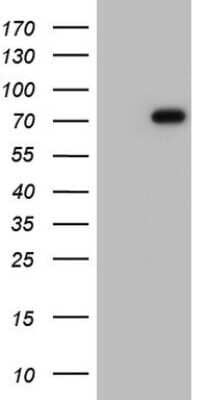 Western Blot: Fibronectin Antibody (OTI5C1) [NBP2-45690]