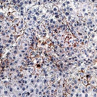 Immunohistochemistry: Fibronectin Antibody (960632) - Azide and BSA Free [MAB8258]