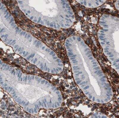 Immunohistochemistry-Paraffin: Fibronectin Antibody (CL3730) [NBP2-61633]