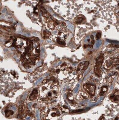 Immunohistochemistry-Paraffin: Fibronectin Antibody (CL3730) [NBP2-61633]
