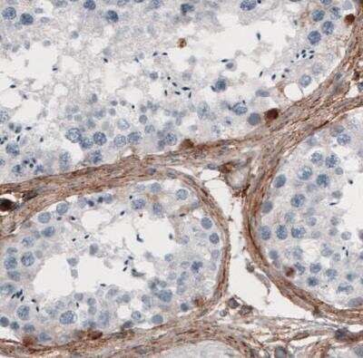 Immunohistochemistry-Paraffin: Fibronectin Antibody (CL3730) [NBP2-61633]
