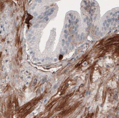 Immunohistochemistry-Paraffin: Fibronectin Antibody (CL3730) [NBP2-61633]