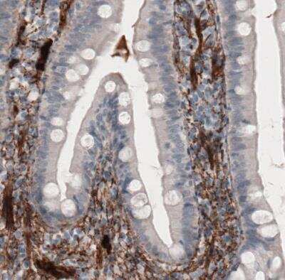 Immunohistochemistry-Paraffin: Fibronectin Antibody (CL3730) [NBP2-61633]