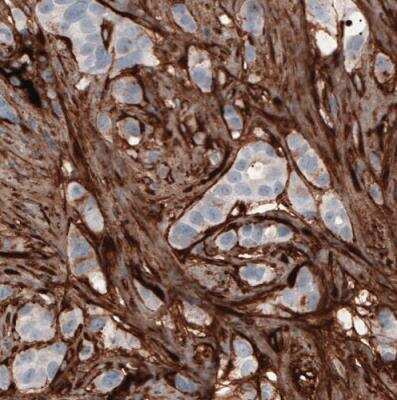 Immunohistochemistry-Paraffin: Fibronectin Antibody (CL3730) [NBP2-61633]
