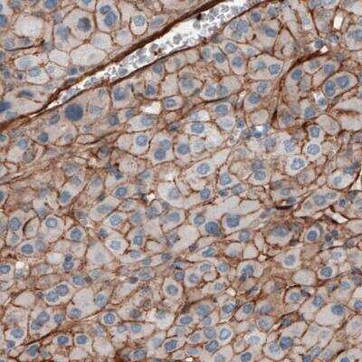 Immunohistochemistry-Paraffin: Fibronectin Antibody (CL3730) [NBP2-61633]