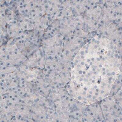 Immunohistochemistry-Paraffin: Fibronectin Antibody (CL3730) [NBP2-61633]