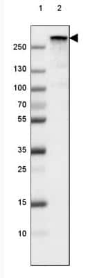 Western Blot: Fibronectin Antibody (CL3730) [NBP2-61633]