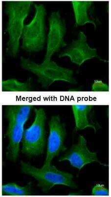 Immunocytochemistry/ Immunofluorescence: Fibronectin Antibody [NBP1-31369]