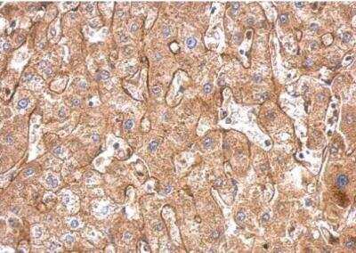 Immunohistochemistry-Paraffin: Fibronectin Antibody [NBP1-31369]