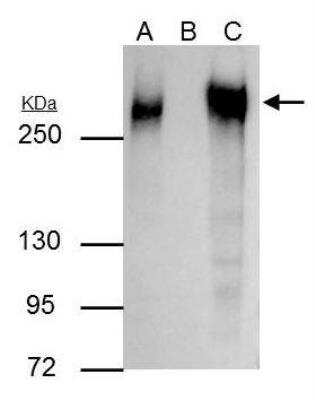 Immunoprecipitation: Fibronectin Antibody [NBP1-31369]