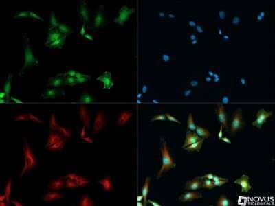 Immunocytochemistry/ Immunofluorescence: Fibronectin Antibody - BSA Free [NBP1-91258]