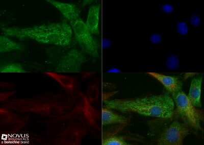 Immunocytochemistry/ Immunofluorescence: Fibronectin Antibody - BSA Free [NBP1-91258]