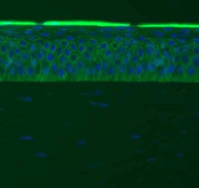 Immunohistochemistry-Frozen: Fibronectin Antibody - BSA Free [NBP1-91258]
