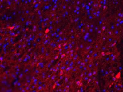Immunohistochemistry-Frozen: Fibronectin Antibody - BSA Free [NBP1-91258]