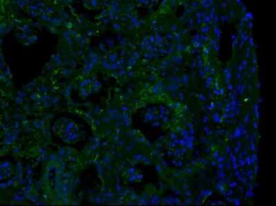Immunohistochemistry-Frozen: Fibronectin Antibody - BSA Free [NBP1-91258]