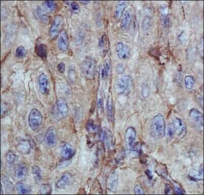 Immunohistochemistry: Fibronectin Antibody - BSA Free [NBP1-91258]