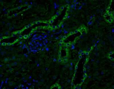 Immunohistochemistry-Paraffin: Fibronectin Antibody - BSA Free [NBP1-91258]