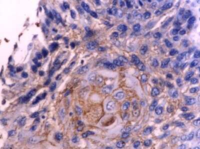Immunohistochemistry-Paraffin: Fibronectin Antibody - BSA Free [NBP1-91258]